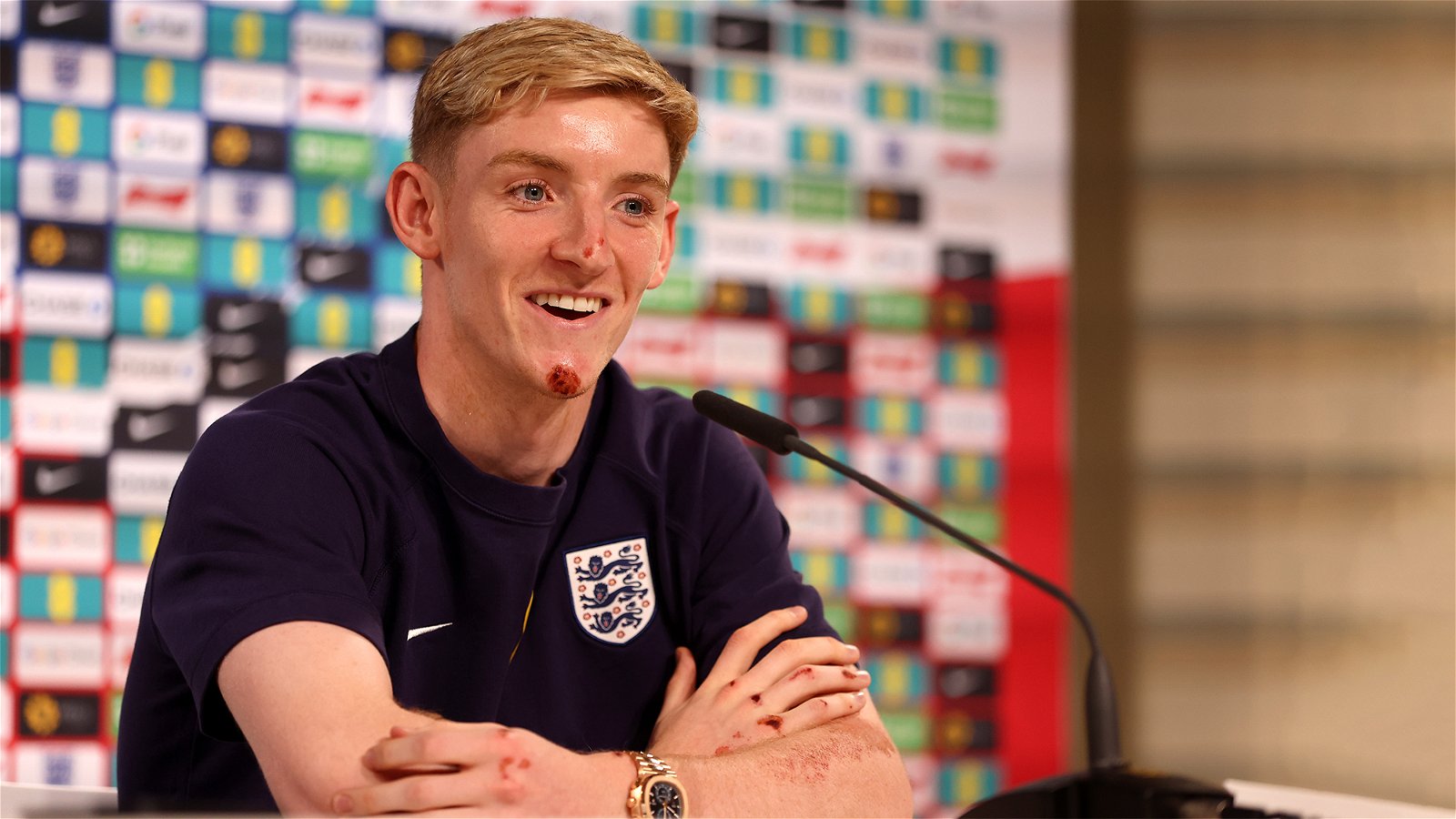 Anthony Gordon put up by England to face the media before Slovakia – Answers the key questions